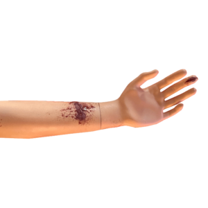 Oefenarm met verwonding